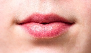 טיפול בשפתיים יבשות בדרך טבעית