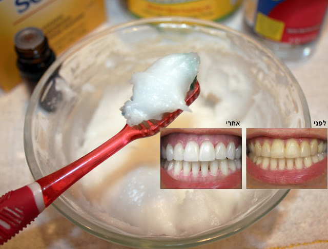 מומחים גילו: משחת שיניים טבעית שיותר טובה ממשחת השיניים שלכם